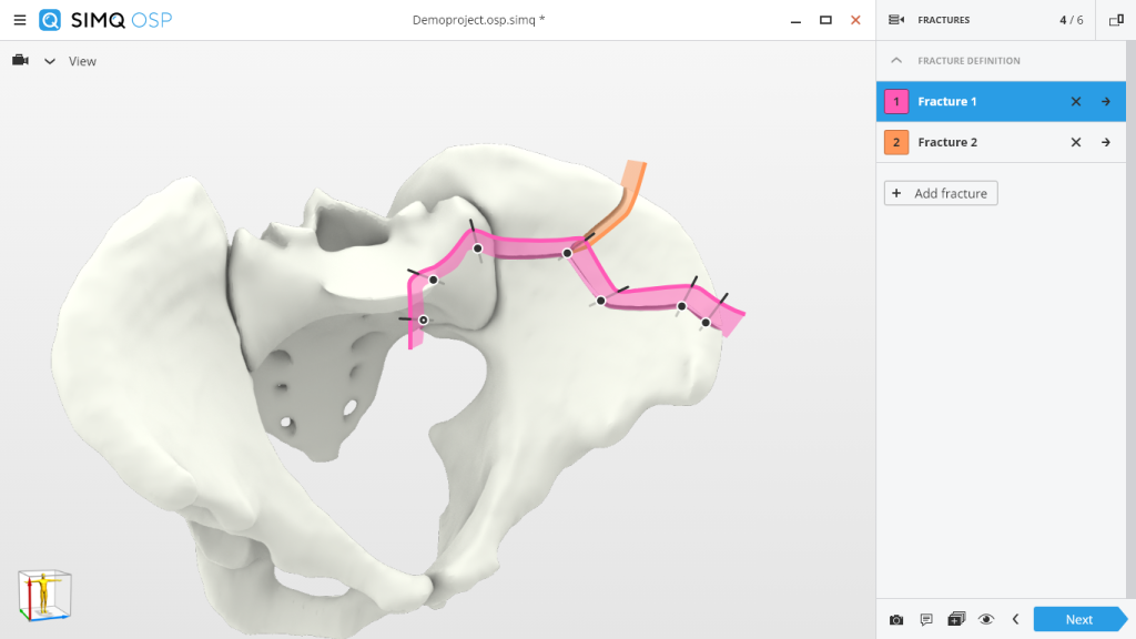 3D virtual pelvis model 