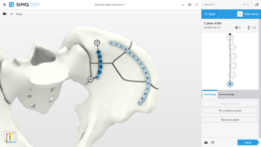 Surgical exploration of the 3D virtual model 